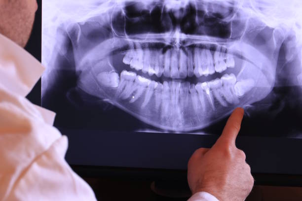 Best Emergency Treatment for Dental Infections or Abscesses in Ault, CO